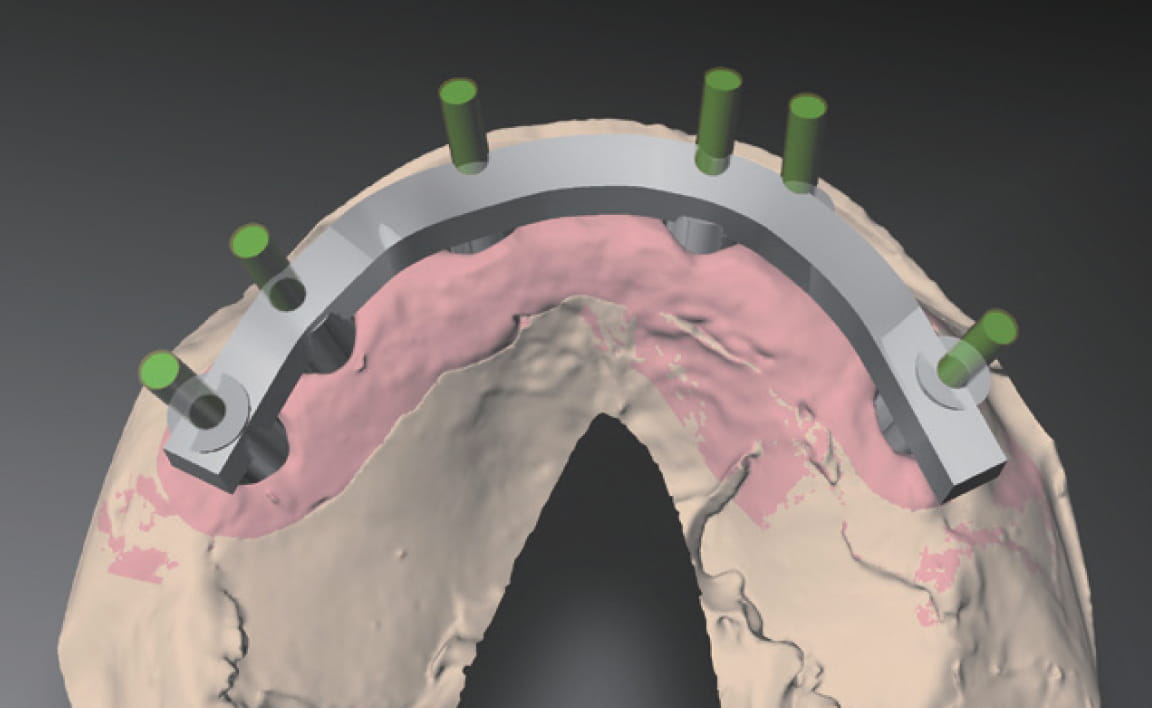 Metal Milling