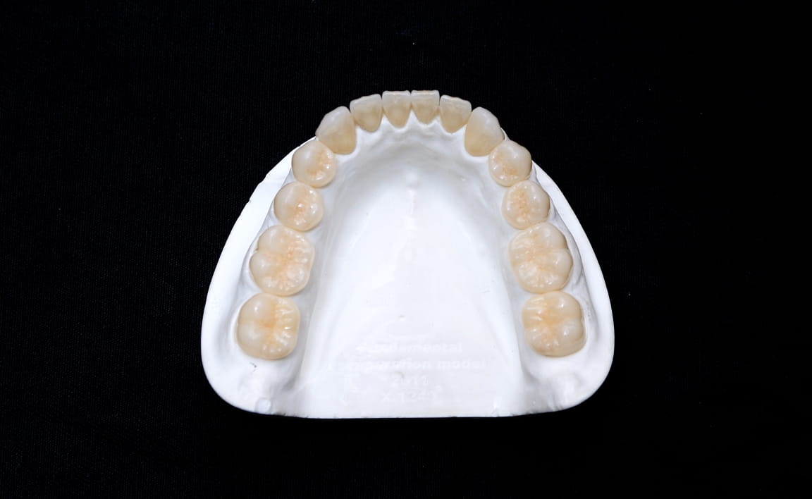 Zirconia Milling