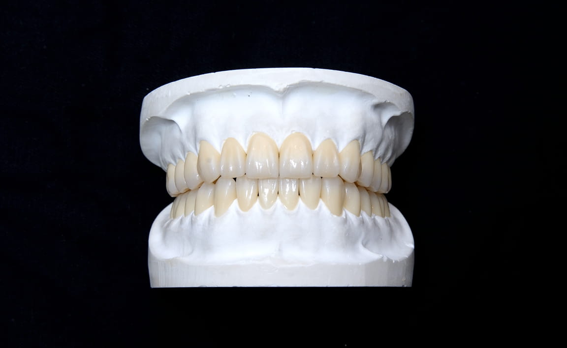 Zirconia Milling